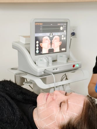 patient-lying-on-treatment-bed-with-ultherapy-machine-screen-showing-face-diagram-during-non-surgical-skin-tightening-session-at-clinic